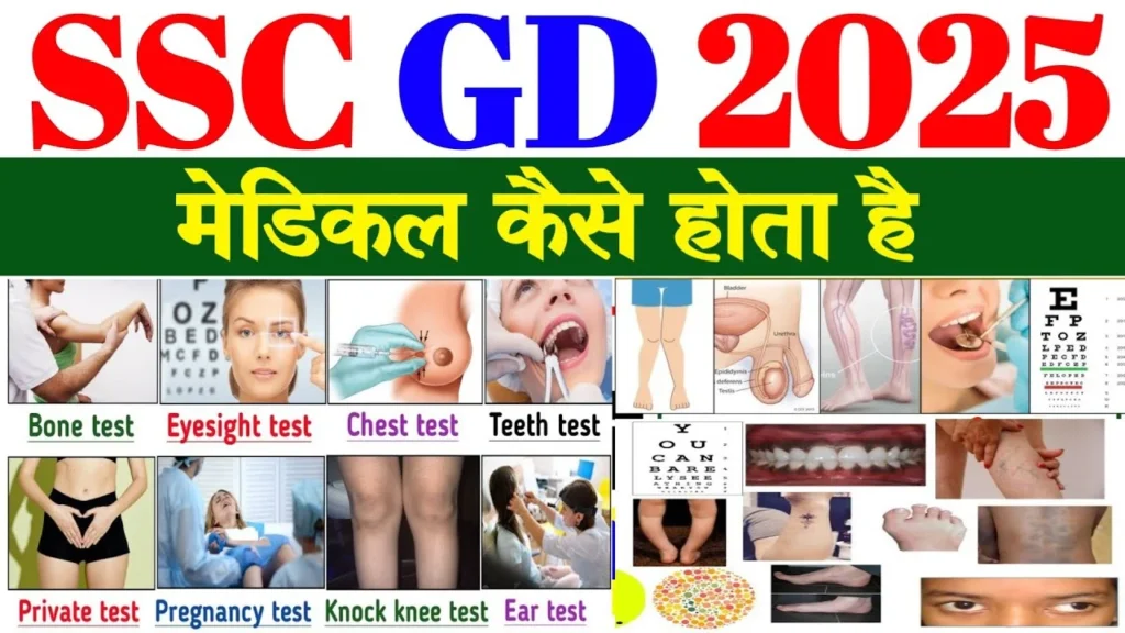 SSC GD Medical Test kaise hota ha 2025 All points ki Details