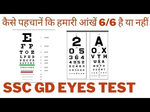 SSC GD Medical Test kaise hota ha 2025 All points ki Details